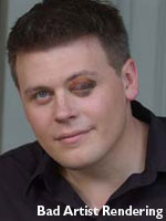 Christian Finnegan with Photoshopped Black Eye